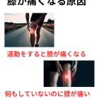 【膝の痛みの新常識】それ、膝ではなく「股関節」のせいかも？